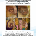 Testimoni Kanker Payudara