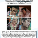 Testimoni Kelenjar Getah Bening