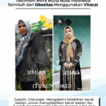 Testimoni Obesitas