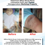 Testimoni Tumor